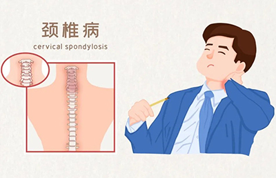 警惕！骨與關節(jié)的“健康危機”，你中招了嗎？